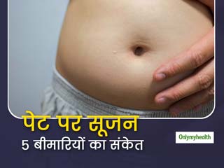 पेट फूला हुआ समझकर पेट पर आई सूजन को न करें नजरअंदाज, इन 5 गंभीर बीमारियों का है संकेत 